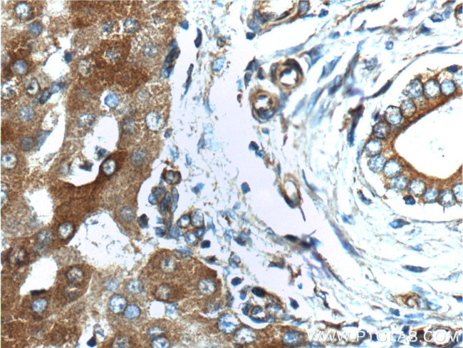 G6PC Antibody in Immunohistochemistry (Paraffin) (IHC (P))