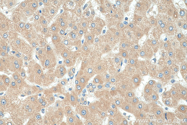 G6PC Antibody in Immunohistochemistry (Paraffin) (IHC (P))