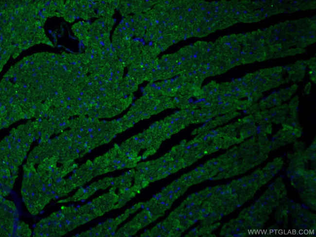 CPT1B Antibody in Immunohistochemistry (PFA fixed) (IHC (PFA))