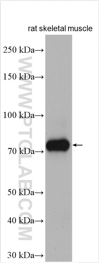 CPT1B Antibody in Western Blot (WB)