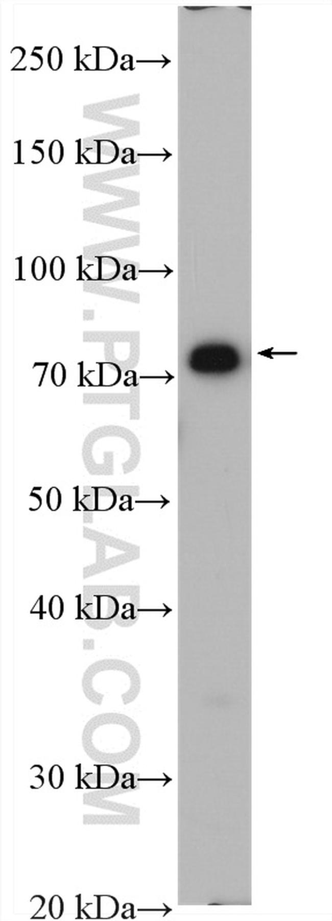 CPT1B Antibody in Western Blot (WB)