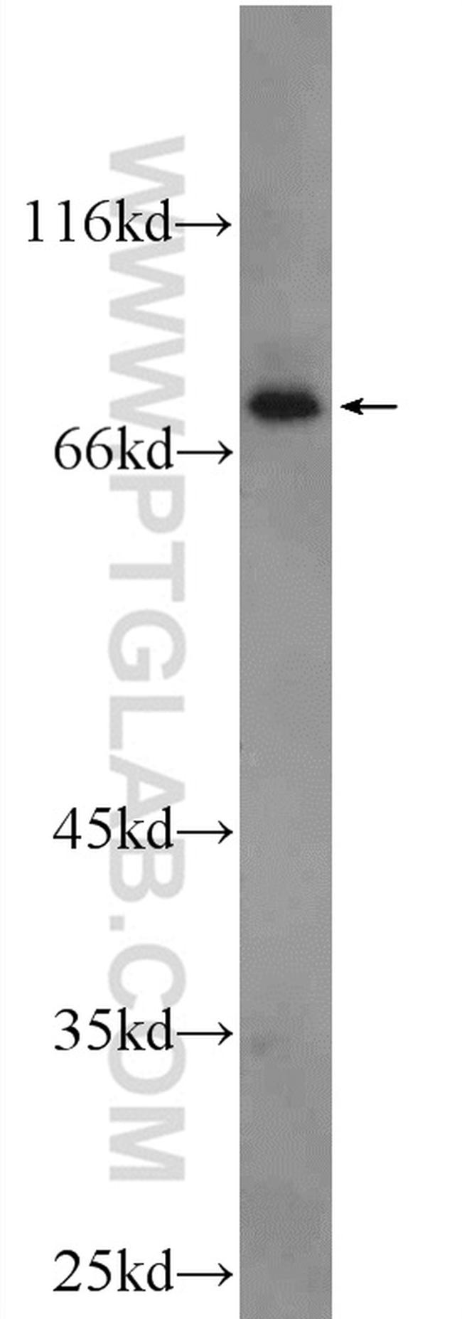 CPT1B Antibody in Western Blot (WB)