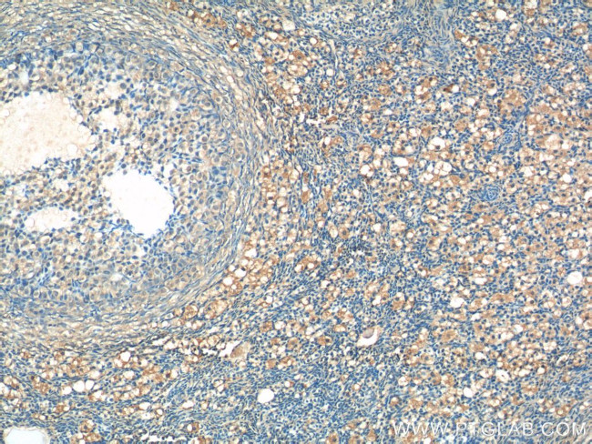 ARHGAP21 Antibody in Immunohistochemistry (Paraffin) (IHC (P))