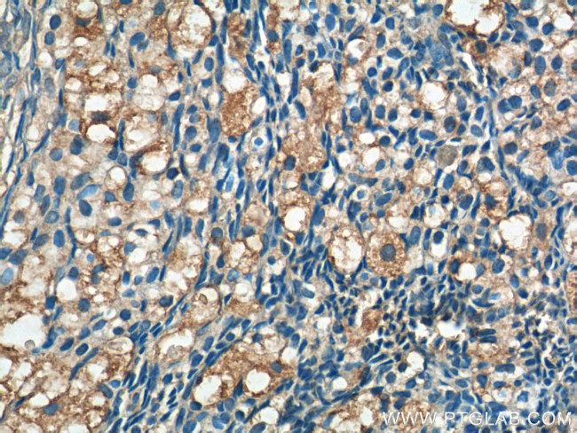 ARHGAP21 Antibody in Immunohistochemistry (Paraffin) (IHC (P))