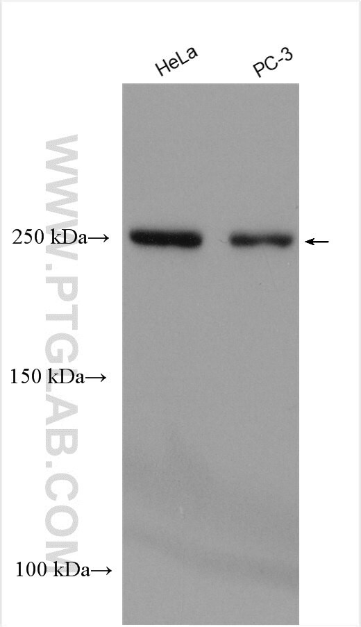 ARHGAP21 Antibody in Western Blot (WB)