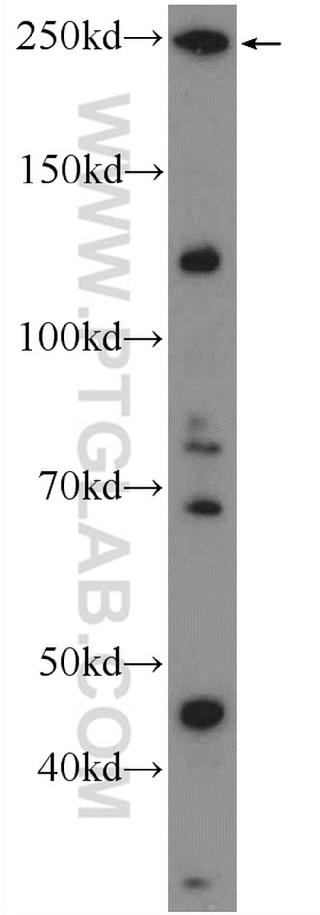 ARHGAP21 Antibody in Western Blot (WB)