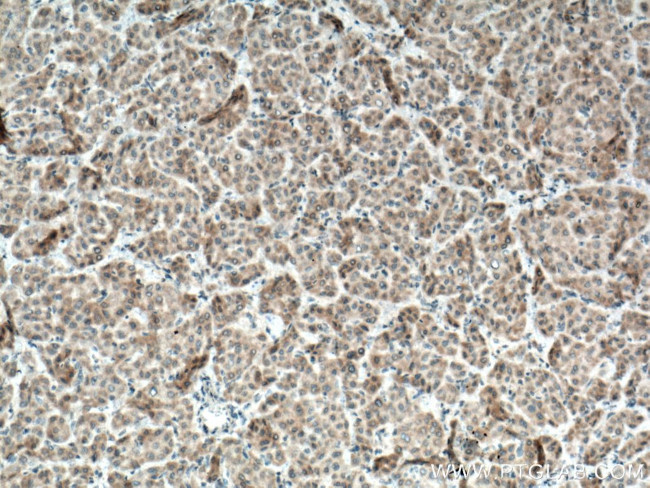 BMP3 Antibody in Immunohistochemistry (Paraffin) (IHC (P))