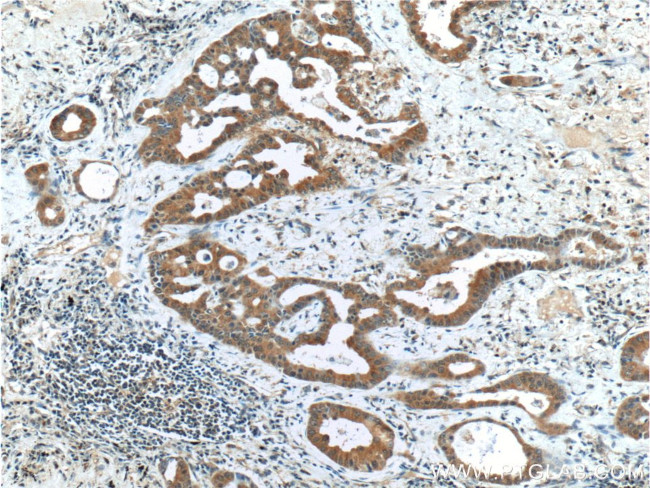 BMP3 Antibody in Immunohistochemistry (Paraffin) (IHC (P))