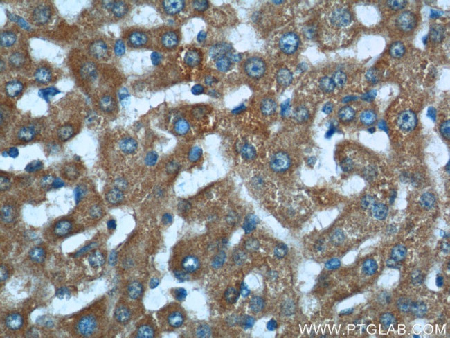 BMP3 Antibody in Immunohistochemistry (Paraffin) (IHC (P))