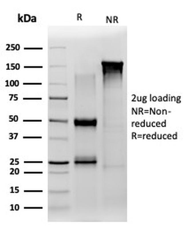 JAZF1 (Transcription Corepressor) Antibody in Immunoelectrophoresis (IE)