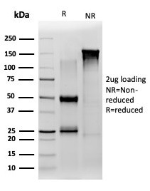 JAZF1 (Transcription Corepressor) Antibody in SDS-PAGE (SDS-PAGE)