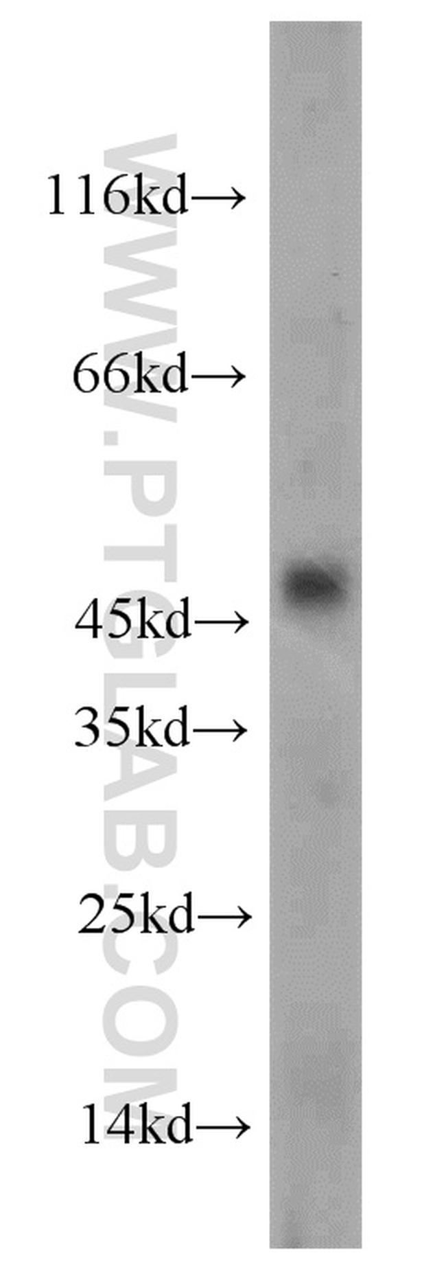 CHRNB4 Antibody in Western Blot (WB)