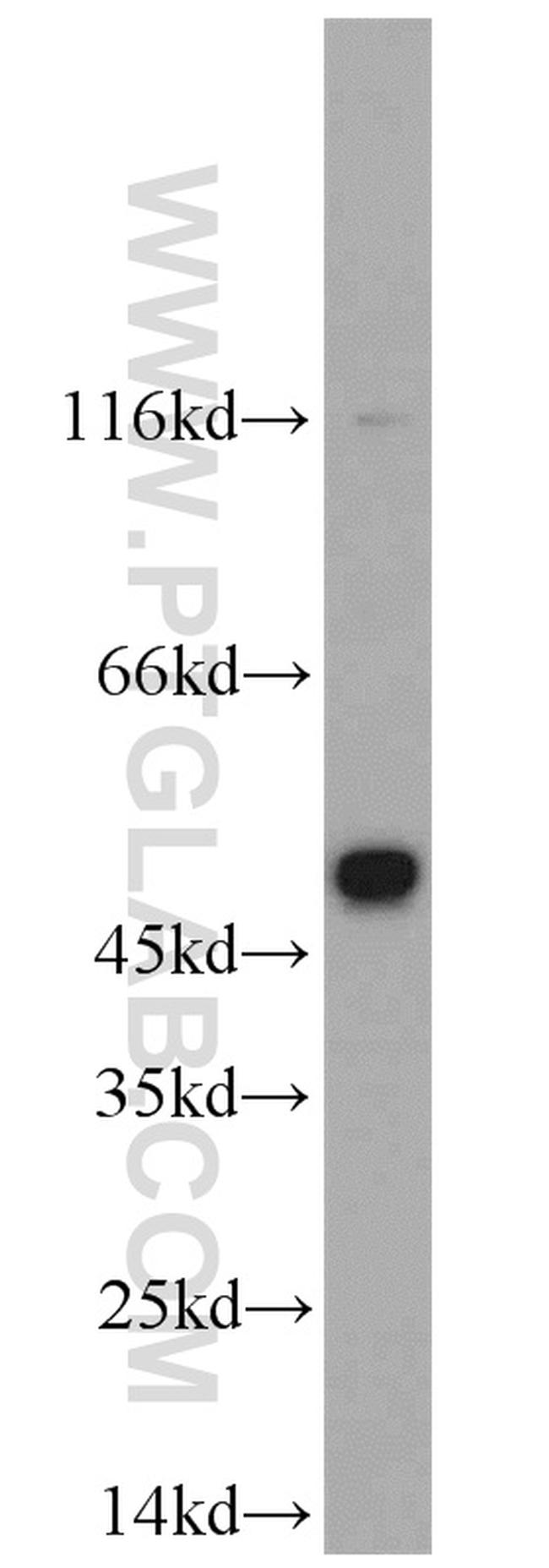 CHRNB4 Antibody in Western Blot (WB)