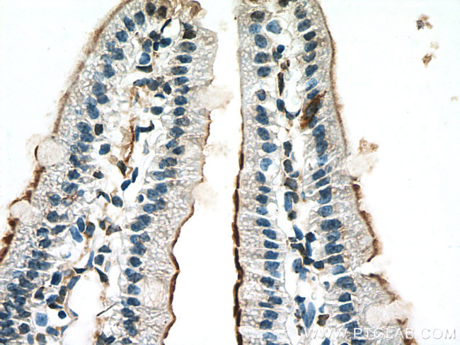 MGAM Antibody in Immunohistochemistry (Paraffin) (IHC (P))