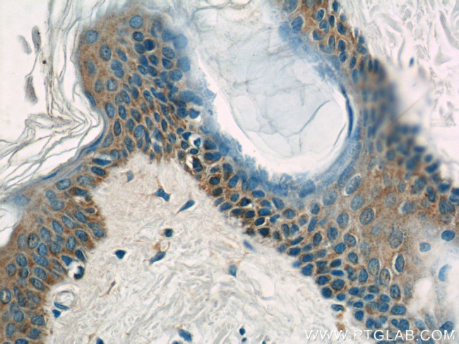 EXPH5 Antibody in Immunohistochemistry (Paraffin) (IHC (P))