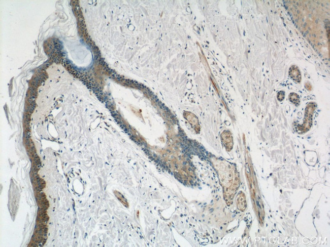 EXPH5 Antibody in Immunohistochemistry (Paraffin) (IHC (P))