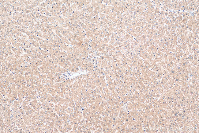 EXPH5 Antibody in Immunohistochemistry (Paraffin) (IHC (P))