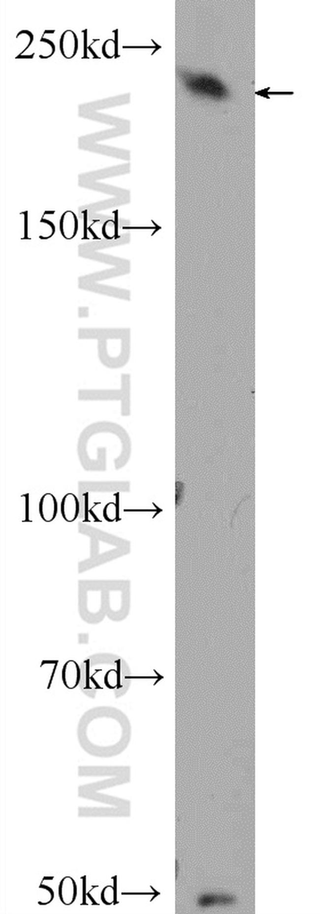 EXPH5 Antibody in Western Blot (WB)