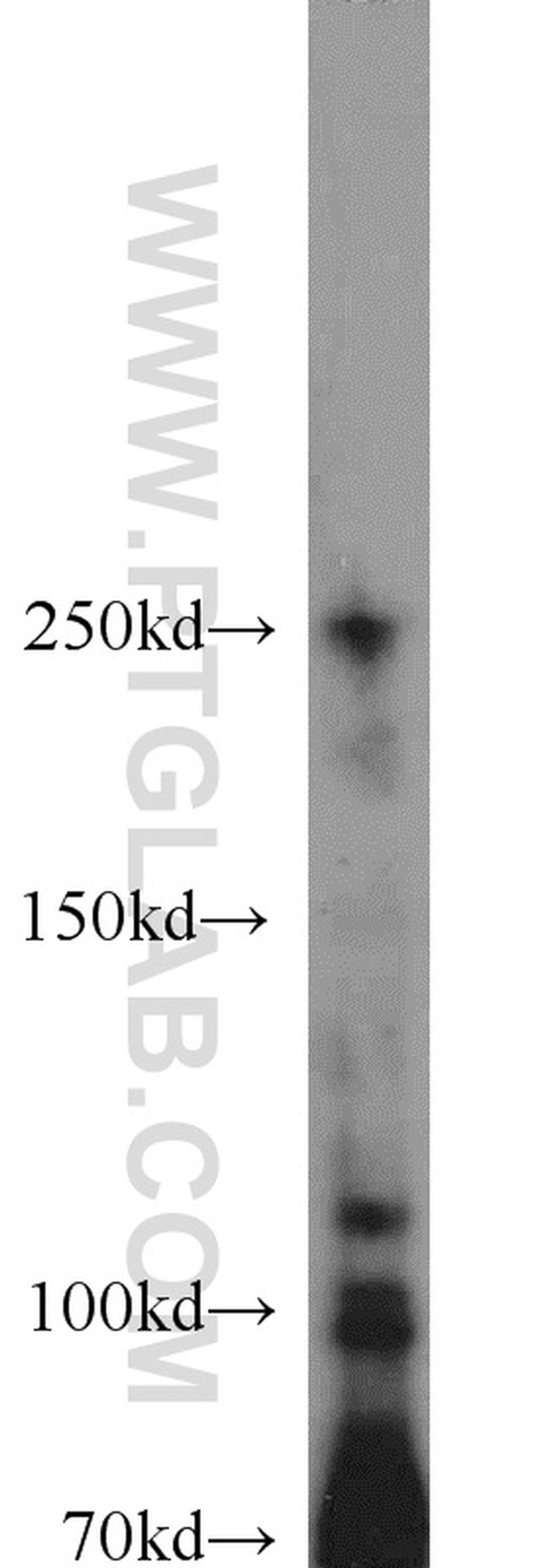 SYK Antibody in Western Blot (WB)