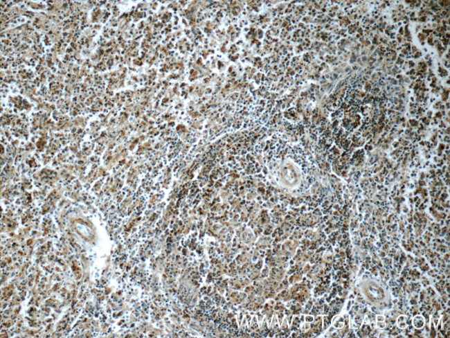 SYK Antibody in Immunohistochemistry (Paraffin) (IHC (P))