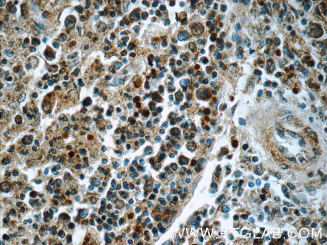 SYK Antibody in Immunohistochemistry (Paraffin) (IHC (P))