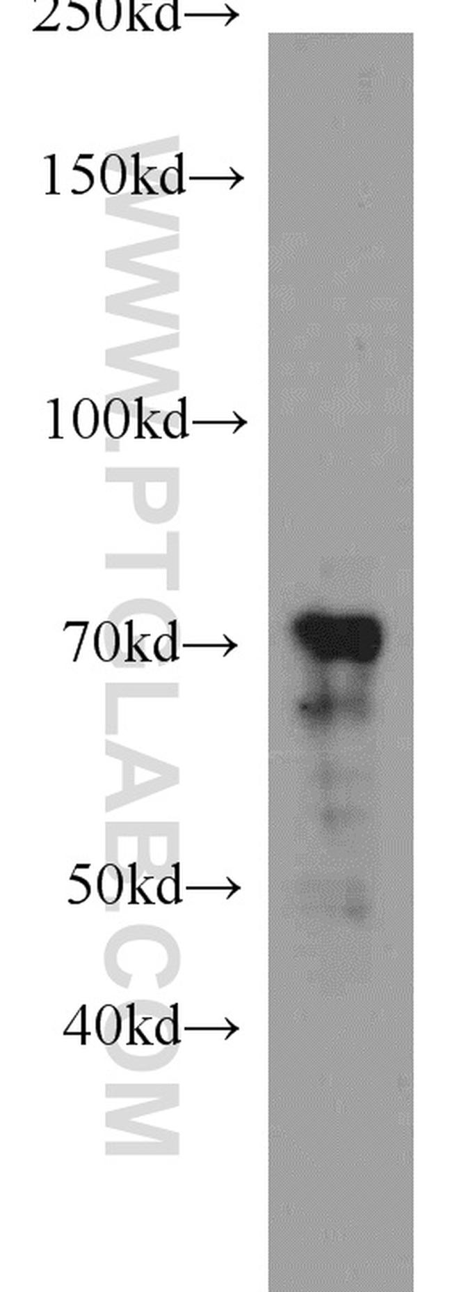 ZAP70 Antibody in Western Blot (WB)