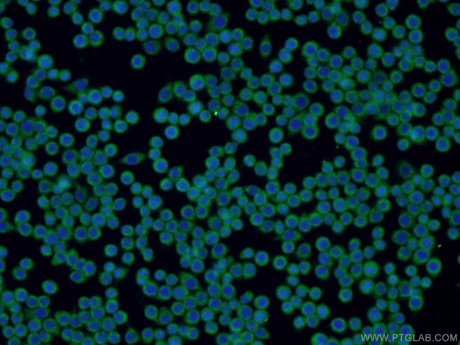 ZAP70 Antibody in Immunocytochemistry (ICC/IF)