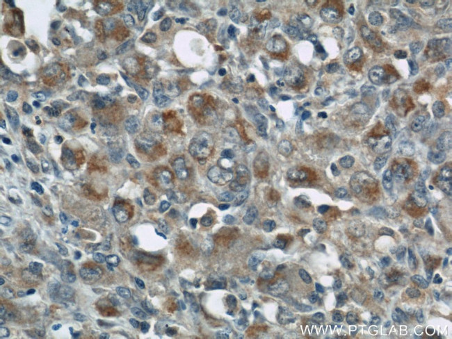 ZAP70 Antibody in Immunohistochemistry (Paraffin) (IHC (P))