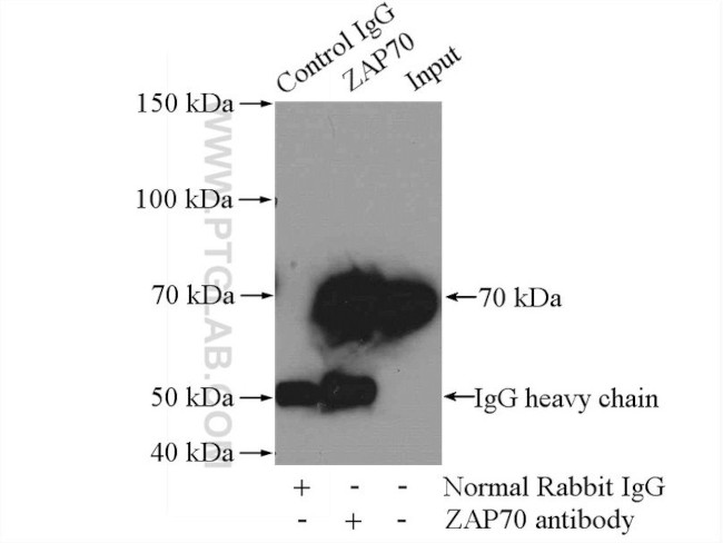 ZAP70 Antibody in Immunoprecipitation (IP)