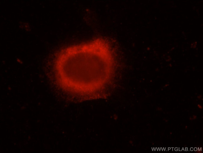 ERC1 Antibody in Immunocytochemistry (ICC/IF)