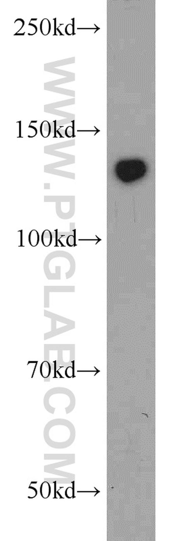 ERC1 Antibody in Western Blot (WB)