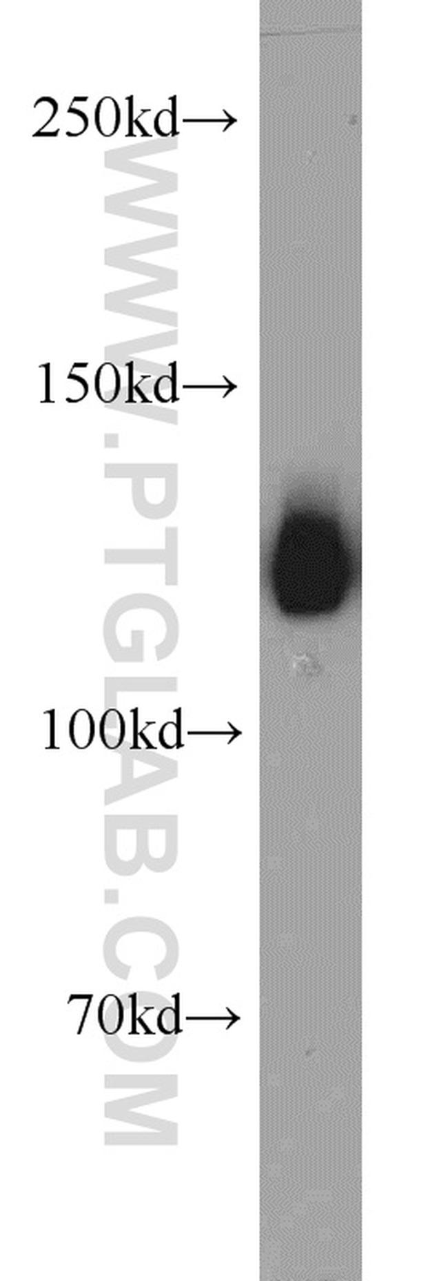 ERC1 Antibody in Western Blot (WB)