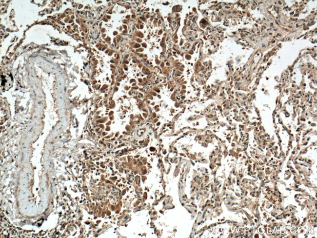 ACP1 Antibody in Immunohistochemistry (Paraffin) (IHC (P))