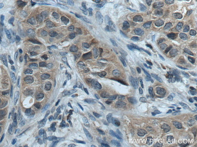 ACP1 Antibody in Immunohistochemistry (Paraffin) (IHC (P))