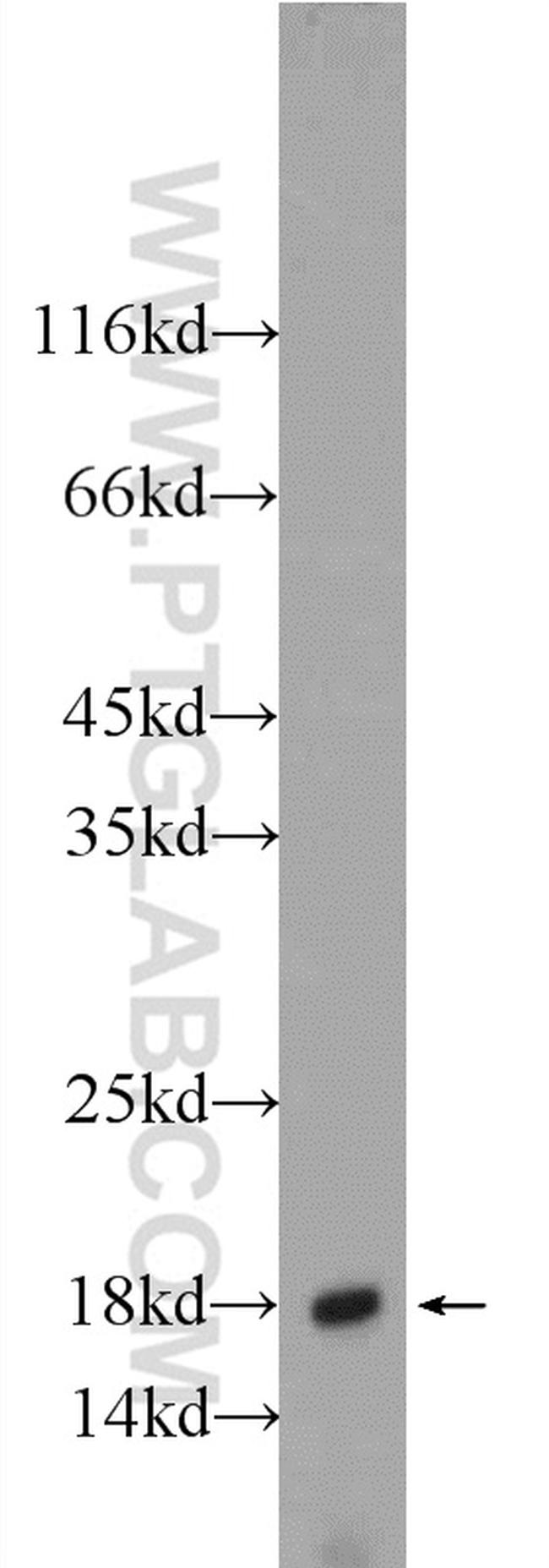 ACP1 Antibody in Western Blot (WB)