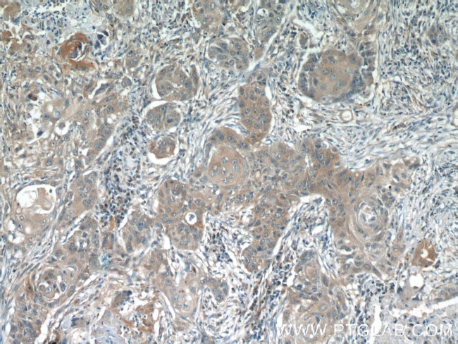 ACP1 Antibody in Immunohistochemistry (Paraffin) (IHC (P))