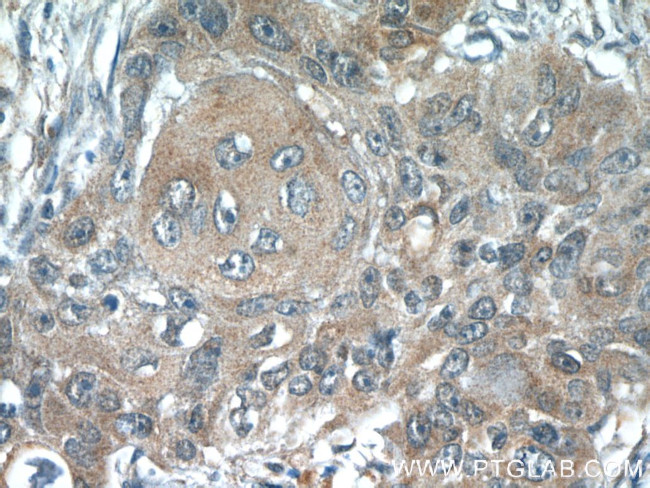 ACP1 Antibody in Immunohistochemistry (Paraffin) (IHC (P))