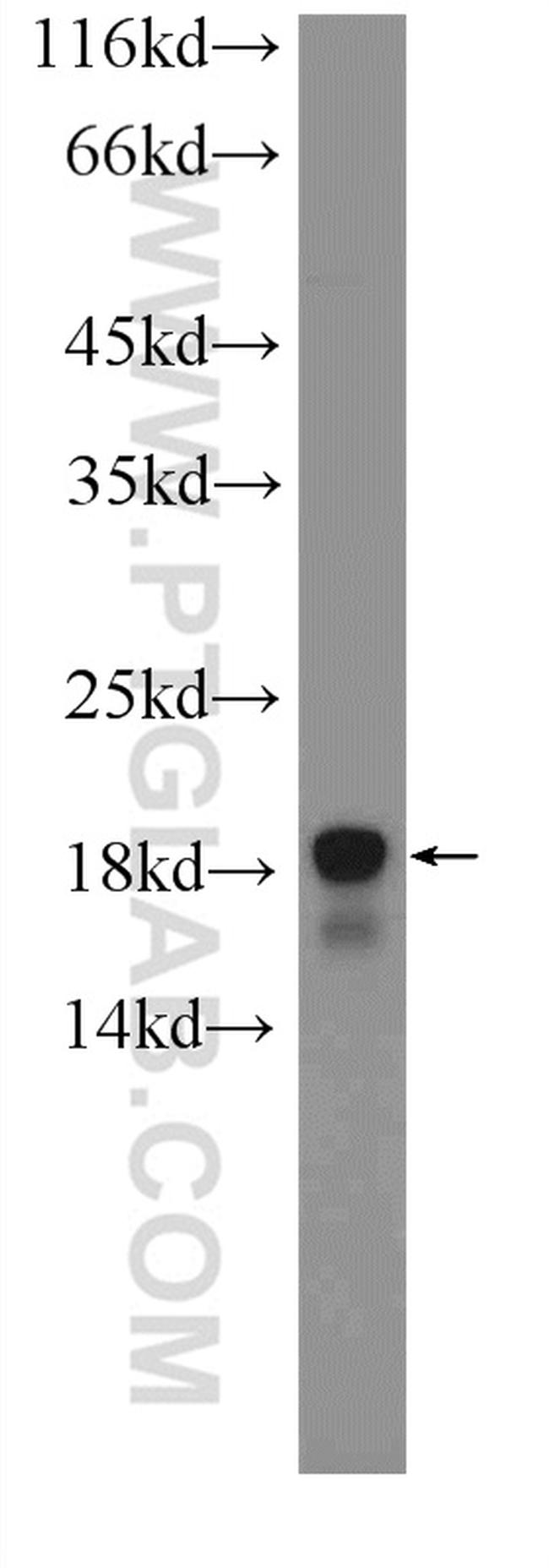 ACP1 Antibody in Western Blot (WB)