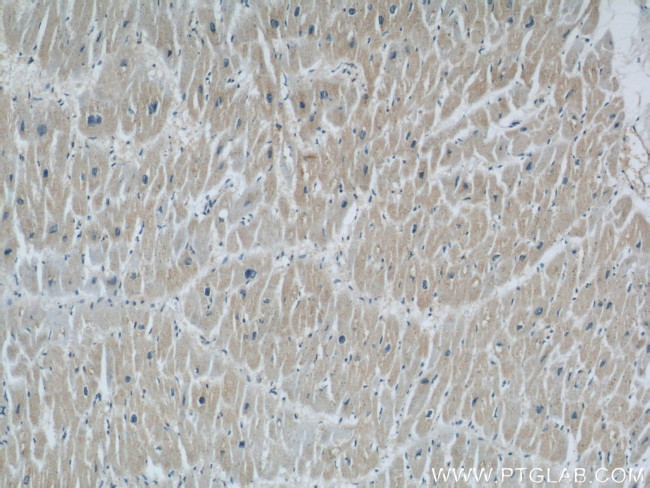 Rabenosyn 5 Antibody in Immunohistochemistry (Paraffin) (IHC (P))