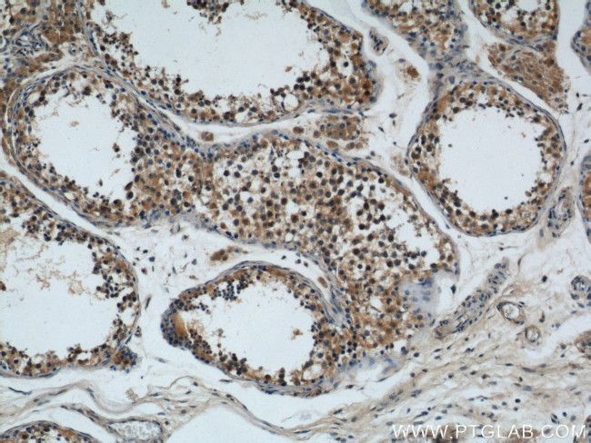 Rabenosyn 5 Antibody in Immunohistochemistry (Paraffin) (IHC (P))