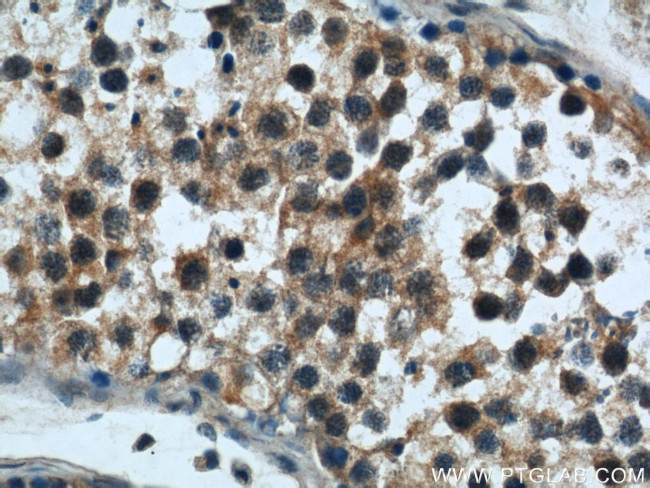 Rabenosyn 5 Antibody in Immunohistochemistry (Paraffin) (IHC (P))