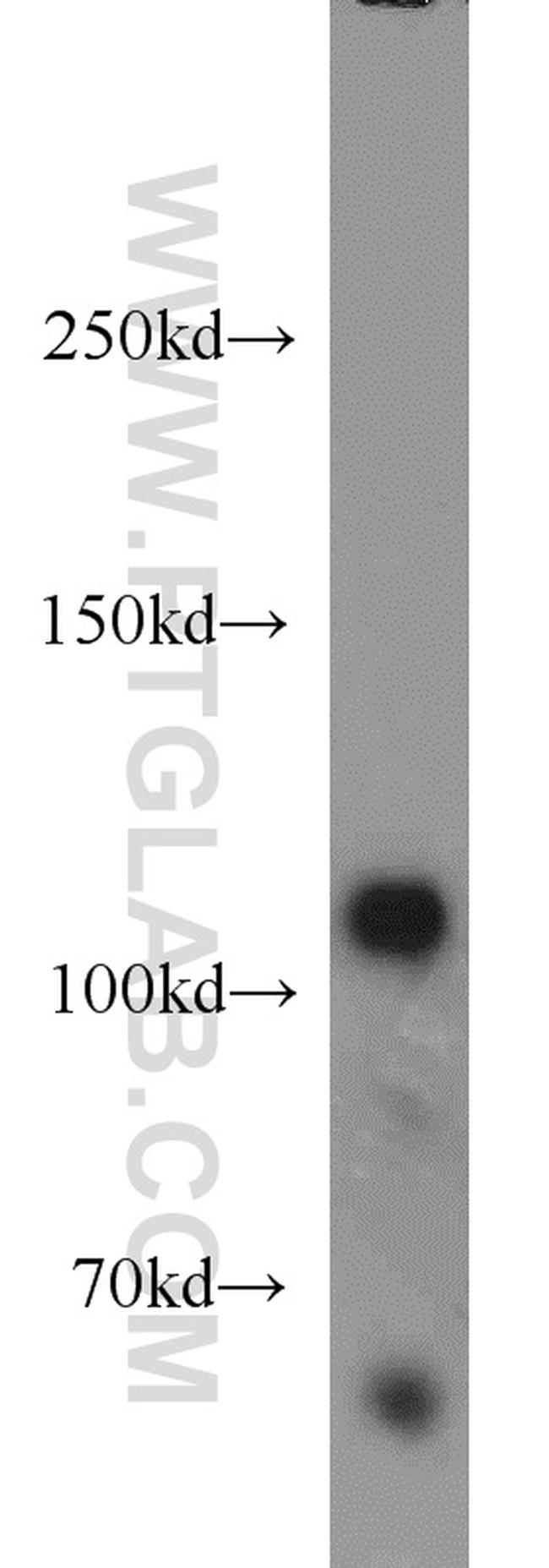 Rabenosyn 5 Antibody in Western Blot (WB)