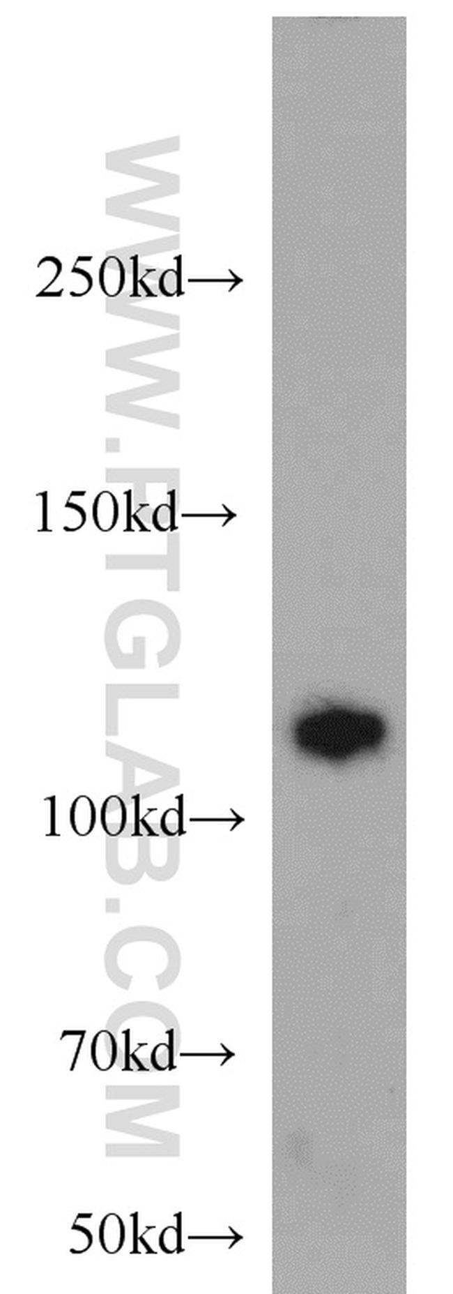 Rabenosyn 5 Antibody in Western Blot (WB)