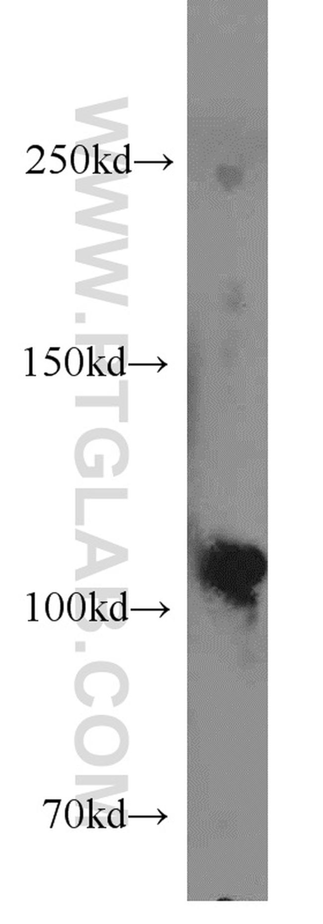 Rabenosyn 5 Antibody in Western Blot (WB)