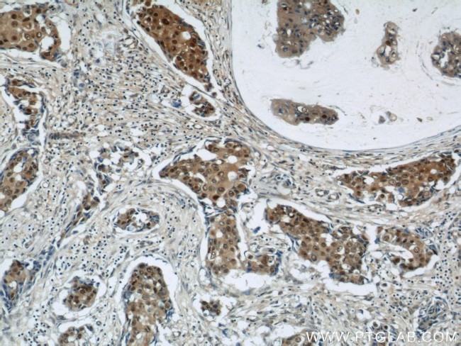 CSE1L Antibody in Immunohistochemistry (Paraffin) (IHC (P))