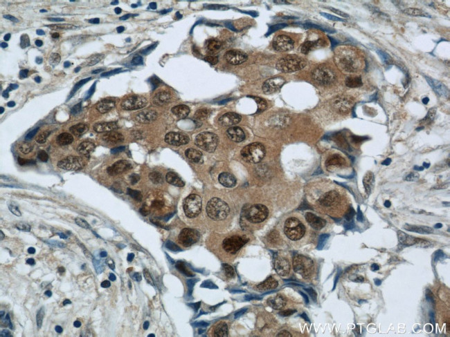 CSE1L Antibody in Immunohistochemistry (Paraffin) (IHC (P))