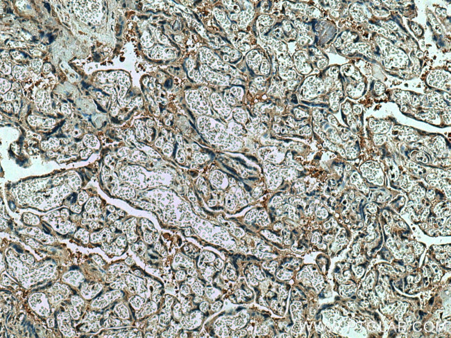 CSE1L Antibody in Immunohistochemistry (Paraffin) (IHC (P))