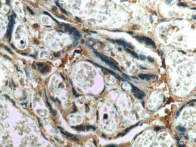 CSE1L Antibody in Immunohistochemistry (Paraffin) (IHC (P))