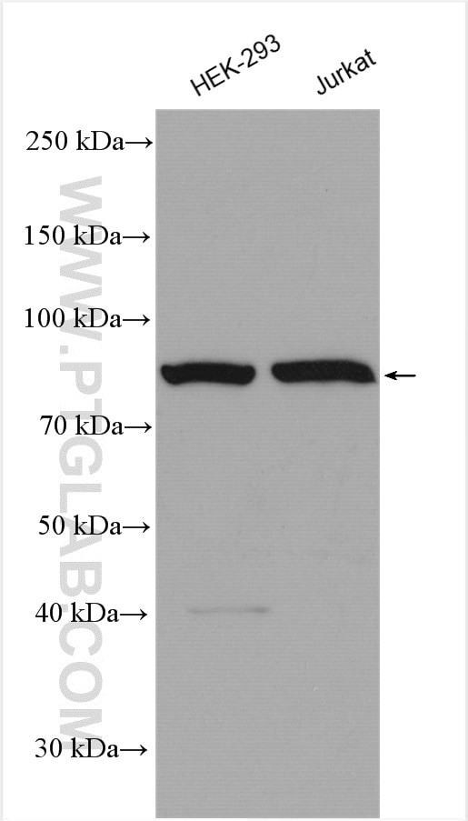 CSE1L Antibody in Western Blot (WB)