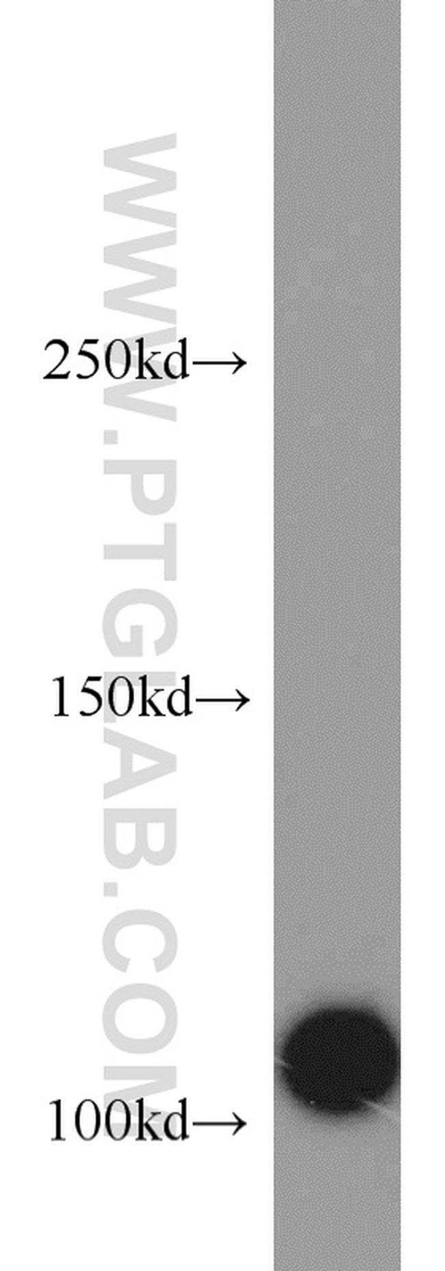 CSE1L Antibody in Western Blot (WB)